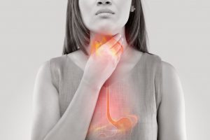 Can Reflux or Heartburn Affect My Voice?